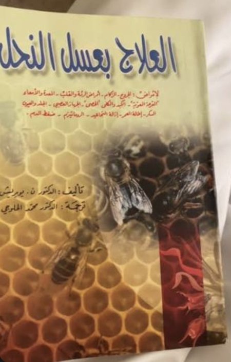 العلاج بعسل النحل